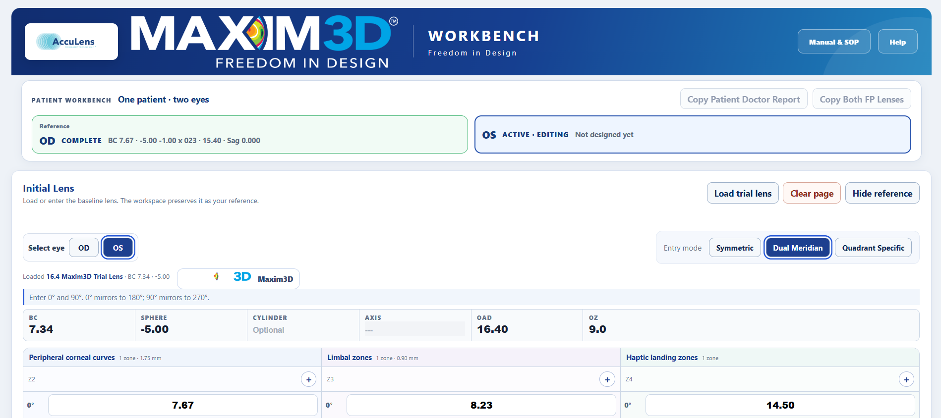 Patient Workbench showing OD complete and OS active